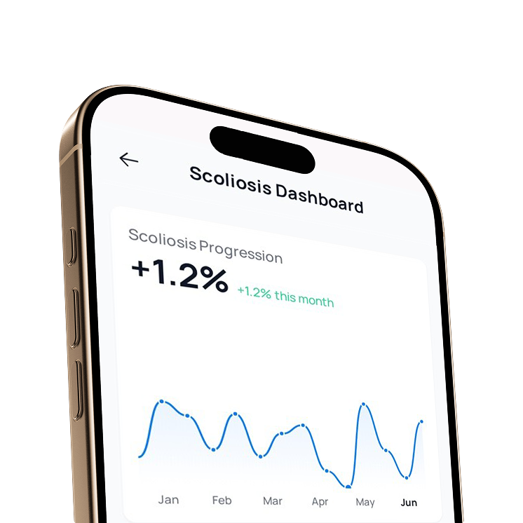 Scoliscan App Interface