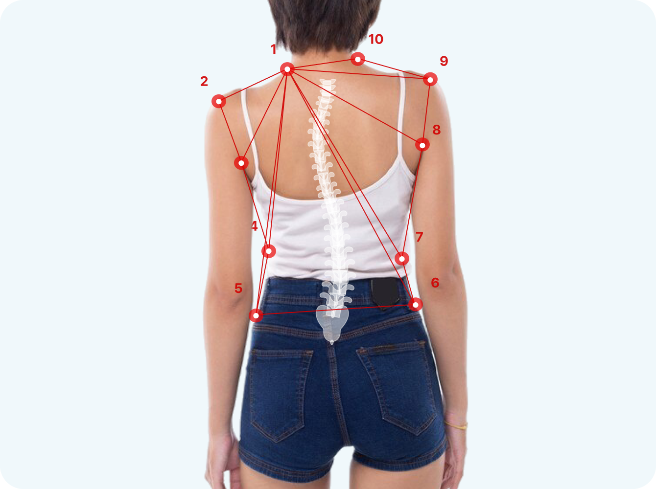 AI 척추 각도 분석