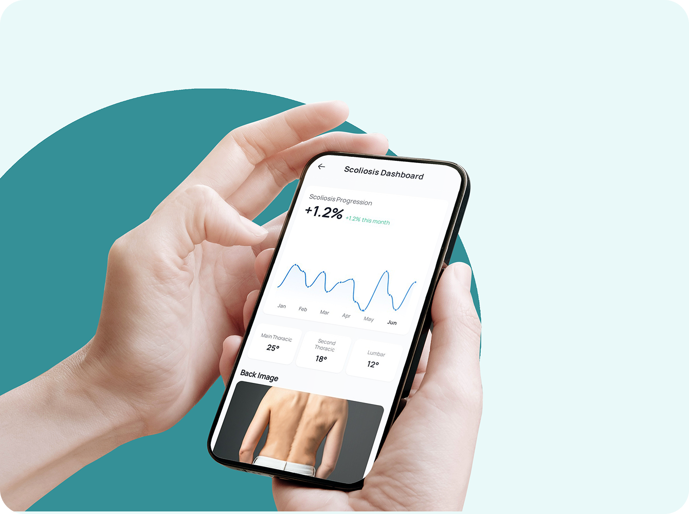 진행 상황 추적